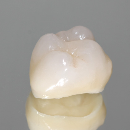 Artificial teeth